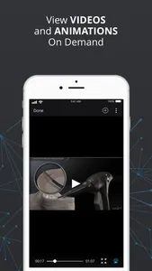 Arthrex Surgeon App screenshot 3