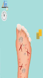 Little Crazy Foot Doctor Games screenshot 1