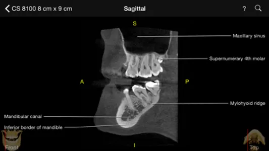 CBCT screenshot 0