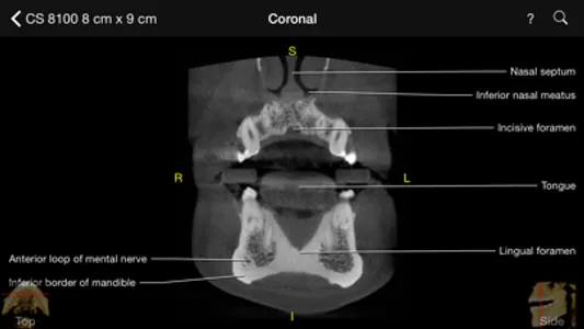 CBCT screenshot 1