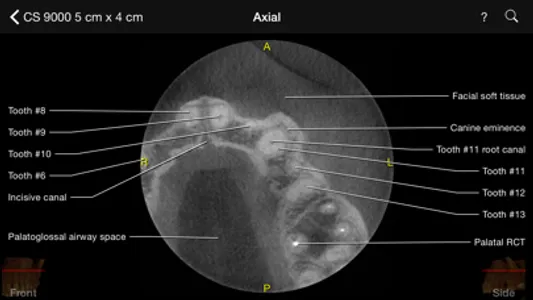 CBCT screenshot 2