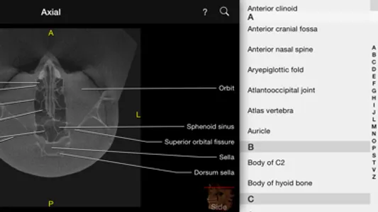 CBCT screenshot 3