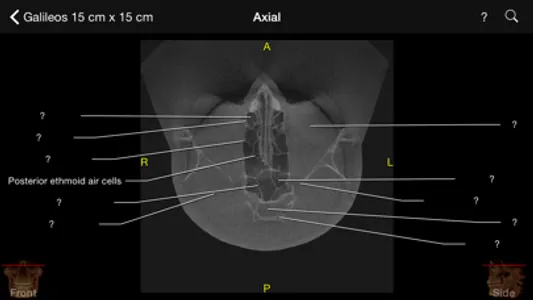 CBCT screenshot 4