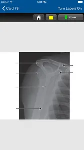 Radiographic Positioning Cards screenshot 3