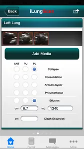 iLungScan™ screenshot 0