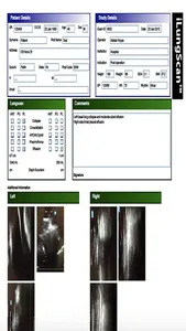 iLungScan™ screenshot 4