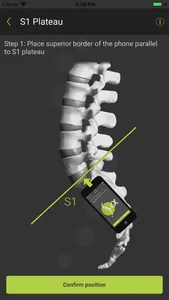 SagittalMeter Lite screenshot 2