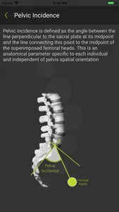 SagittalMeter Lite screenshot 3
