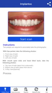 Implantoo screenshot 2