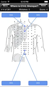 Acupuncture Points Body Quiz screenshot 1