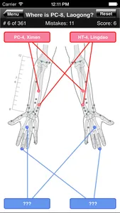 Acupuncture Points Body Quiz screenshot 2