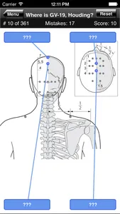 Acupuncture Points Body Quiz screenshot 3