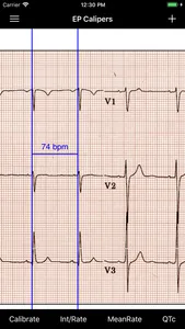 EP Calipers screenshot 1