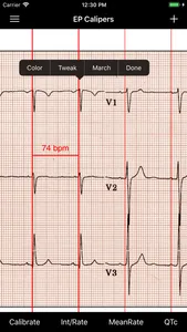 EP Calipers screenshot 2