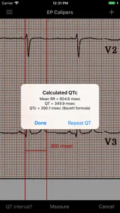 EP Calipers screenshot 3