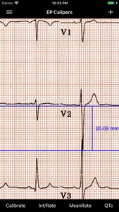 EP Calipers screenshot 5