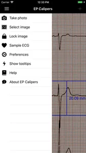 EP Calipers screenshot 6