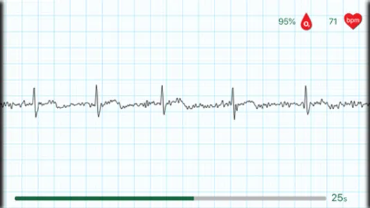 WIWE - ECG diagnostics screenshot 1