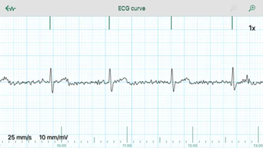 WIWE - ECG diagnostics screenshot 6