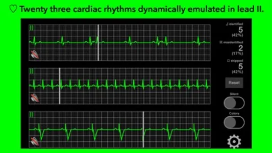 arrhythmia screenshot 0