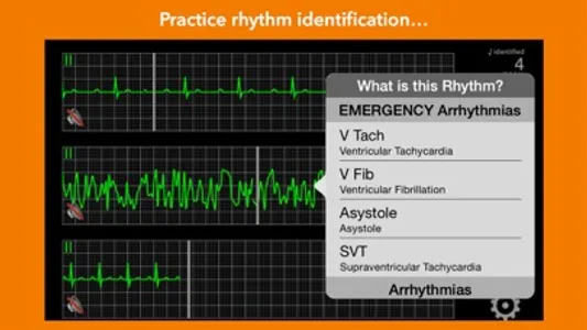 arrhythmia screenshot 1