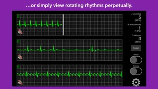 arrhythmia screenshot 2